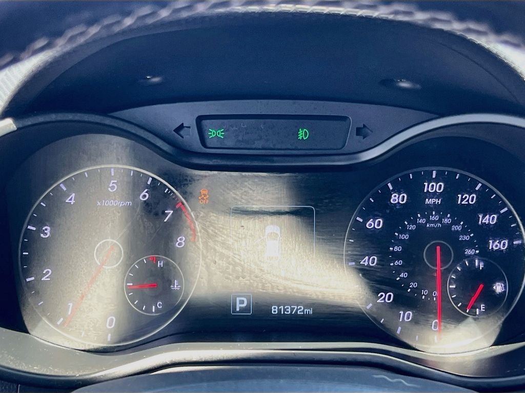2016 Hyundai Veloster Turbo